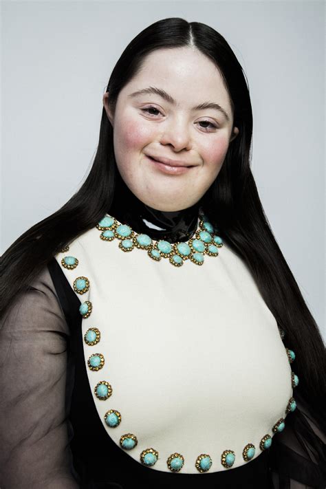 gucci model with down syndrome|down syndrome model.